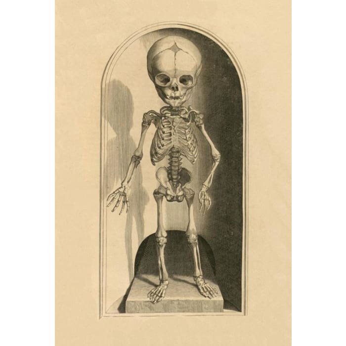 Antique 17th C. Infant Skeleton Medical A3 Poster Reprint - 